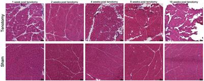 Transcriptional Time Course After Rotator Cuff Tear